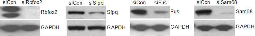 siRNA를 사용한 단백질 발현 저해 효과 확인. 1 ug의 siRNA를 HeLa 세포에 30시간 동안 처리한 후 western blot을 이용하여 단백질 발현을 확인