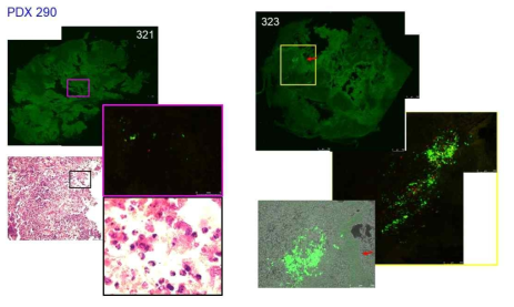 PDX-290 암 덩어리에서의 형광 단백질의 발현 및 neutrophil infiltration. 321, 323 마우스에서 적출한 암 덩어리의 형광사진 (왼쪽 오른쪽 위), H & E staining 사진 (왼쪽 아래), 그리고 bright field 이미지와 형광 이미지가 합쳐진 사진 (오른쪽 아래)