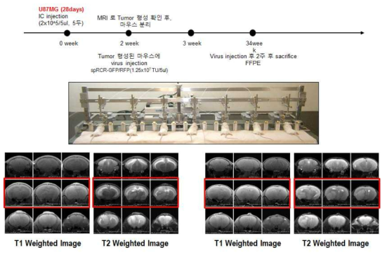 U87MG의 MRI 결과, tumor 형성 확인