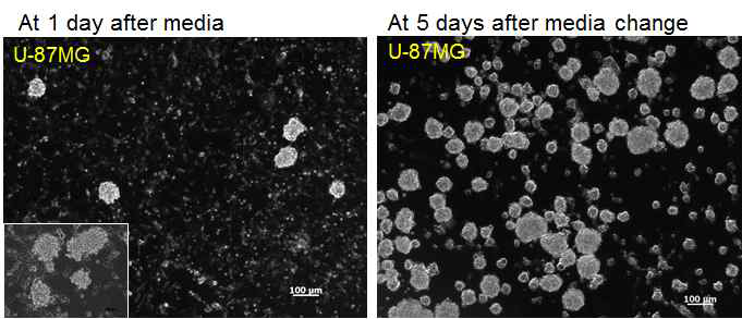 U-87MG 유래 neuroshere 배양