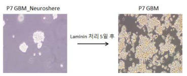 Laminin 처리 후 Patient7 GBM morphology