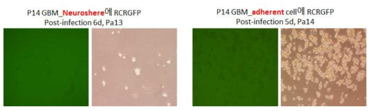 Patient14 GBM에서 바이러스 퍼짐 및 Laminin 처리 후 퍼짐효율