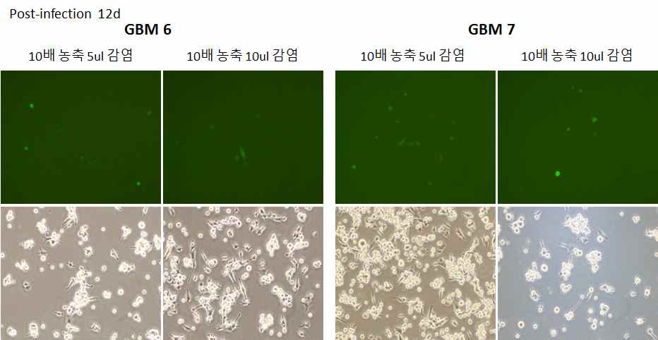 SAHA 처리 후 GBM에서 RRV-GFP 감염 및 퍼짐 효과 확인