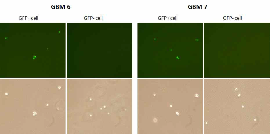 FACS sorting 후 GBM (GFP+/GFP-)