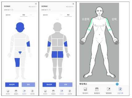 SCORAD, 인체도 기록 화면