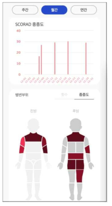 SCORAD의 누적과 양상 모니터링