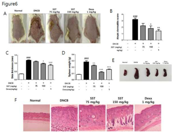 To examine severity, photographs of mouse hairless dorsal skin were taken before mice were sacrificed on the 18th day of the start experiment (A). The clinical severity score of all mouse dorsal skin lesions was assessed according to the standard evaluation criteria (B). The mice were sacrificed and the skin was removed. Dorsal skin thickness of each mouse was measured three times in micrometer (C). The spleen weights of 6 mice per group were measured electronically (D) and pictures were taken to aid visual comparisons (E). The cut dorsal skin was fixed in 10% formalin for one day, then cut into 6 μm sections and stained with hematoxylin and eosin (H&E). Photographs of each group represent images of all mice (n = 6). Images were taken at ×100 original magnification (F). ###p<0.001 vs Normal group, *p<0.05, **p<0.01, or ***p <0.001 vs DNCB-induced group