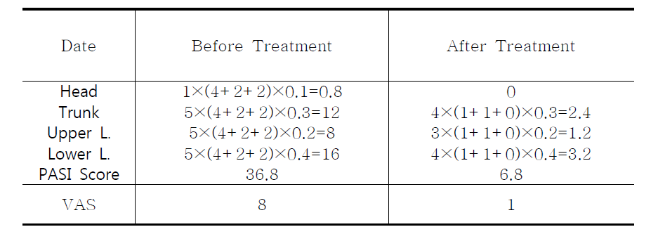 Case 2: Clinical Progress of PASI & VAS