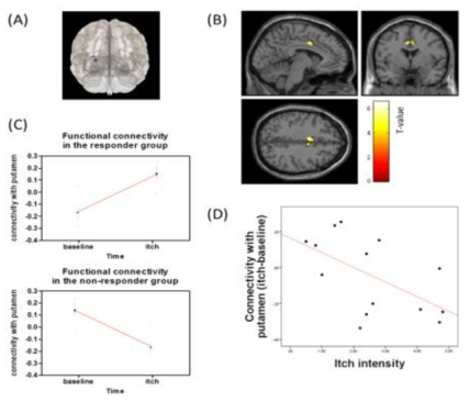 Functional connectivity of putamen and ACC using fMRI