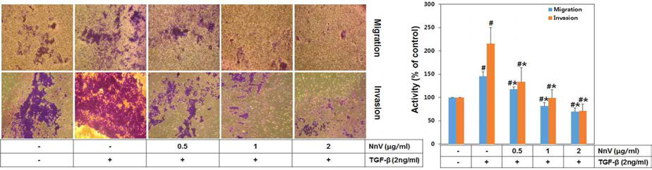 TGF-β1에 의해 활성화된 HSC-T6 세포에서 NnV에 의한 migration과 invasion 억제 효과 확인