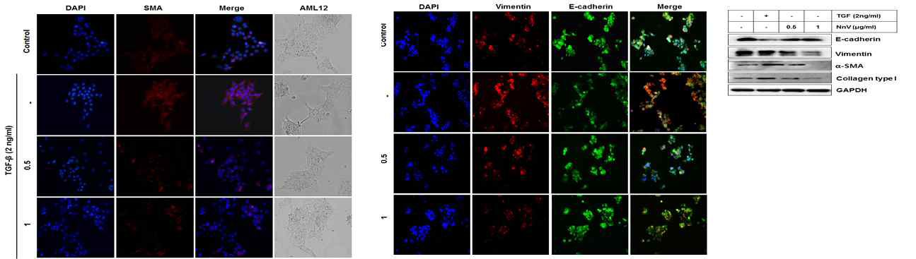 TGF-β1을 처리한 AML12 세포에서 NnV 투여에 따른 α-SMA와 EMT 발현 변화
