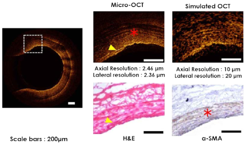 돼지 정상 관상동맥의 μOCT영상과 그 확대를 조직 면역학 영상과의 비교
