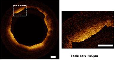 μOCT를 활용하여 촬영한 ex vivo 토끼 혈관