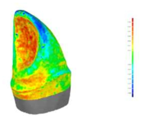 CT 영상과 광학스캐너로 얻은 CAD 데이터 상의 차이. 적색은 양의 오차를, 청색은 음의 오차를 나타낸다