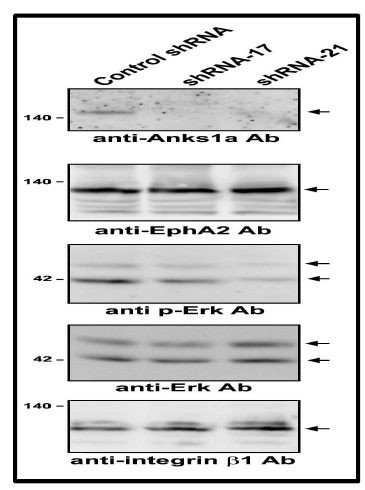 Anks1a KD 세포주에서의 Erk phosphorylation 수준 분석