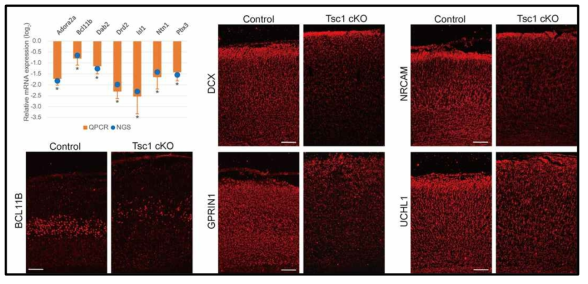 Expression of markers from omics analyses of Hyperactivated mTOR signaling