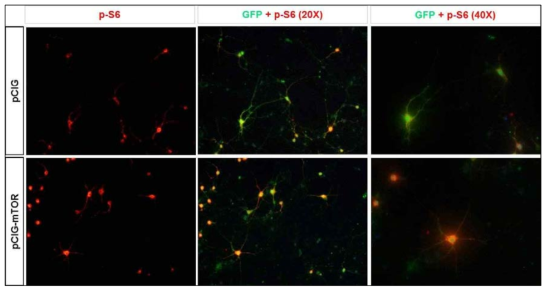 p-S6의 발현을 통하여 과발현된 mTORC1의 발현증가를 확인