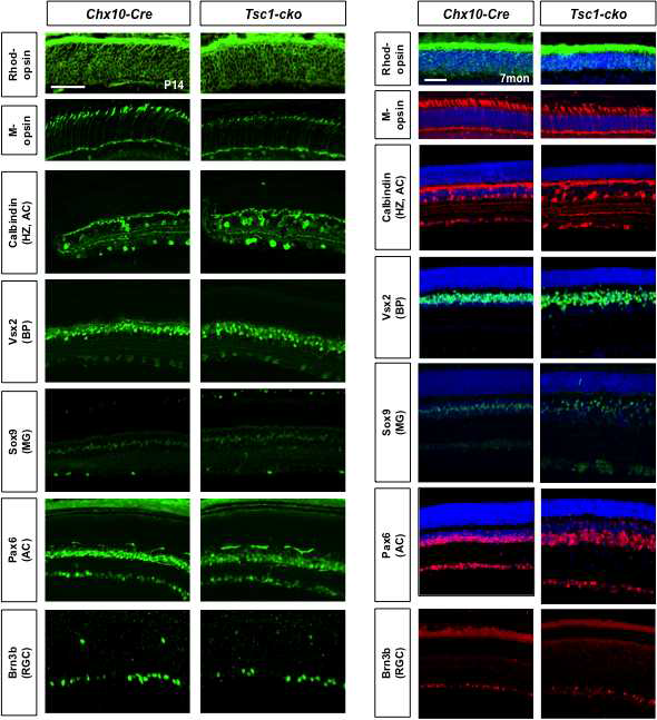 Tsc1-cko 생쥐 망막 신경세포 분포 이상. 신경발달이 마무리되고 시각 반응을 시작하는 생후 14일 (post-natal day 14 (P14))과 성체인 7개월령 (7mon)의 생쥐 안구 절편을 각 망막신경세포에 대한 항체를 이용하여 면역형광염색을 수행함. 그 결과, Tsc1 유전자가 제거된 생쥐 망막신경 발달에는 큰 영향이 없는 것으로 확인됨 (왼쪽). 하지만, 7개 월령의 Tsc1-cko 생쥐 망막에서 inner nuclear layer (INL)에 위치한 신경세포들의 분포가 부정렬 상태를 보임. 이는 INL을 구성하는 망막의 inter neuron들의 구조적 이상이 생겼음을 의미하는 결과로 해석됨. 또한, outer nuclear layer (ONL)에 위치하는 광수용세포의 수가 정상보다 약 15-20% 정도 줄어든 것을 알 수 있음
