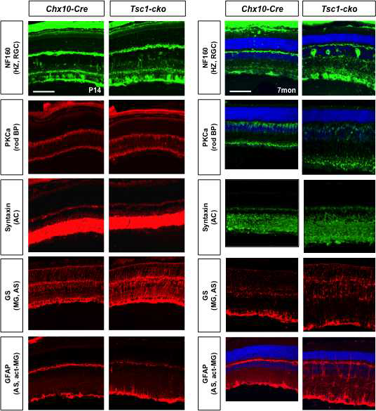 Tsc1-cko 생쥐 망막 신경네트워크 형성 이상. 신경발달이 마무리되고 시각 반응을 시작하는 생후 14일 (post-natal day 14 (P14))과 성체인 7개월령 (7mon)의 생쥐 안구 절편을 각 망막신경세포에 대한 항체를 이용하여 면역형광염색을 수행함. 그 결과, 위의 그림 2와 마찬가지로 Tsc1 유전자가 제거된 생쥐 망막신경네트워크의 발달에는 큰 영향이 없는 것으로 확인됨 (왼쪽). 하지만, 7개월령의 Tsc1-cko 생쥐 망막에서 inner nuclear layer (INL)에 위치한 신경세포들의 분포가 부정렬 상태를 보이며 이들로부터 뻗어 나온 신경 말단의 시냅스 구조 역시 부정렬을 보임. 이는 INL을 구성하는 망막의 inter neuron들의 구조적 이상이 생겼음을 의미하는 결과로 해석됨. 위의 결과와 이 결과를 종합하면 Tsc1이 제거되어 mTOR가 과도하게 활성화되면 망막신경세포의 운명은 큰 차이가 없으나 이들의 구조적 이상에 의해 점차 망막신경 퇴화 현상이 일어남을 알 수 있음