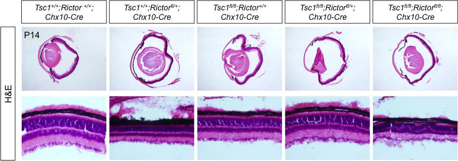 Rictor-cko 및 Rictor;Tsc1-cko 생쥐 제작. Tsc1-cko 생쥐 망막에서 나타난 신경발달 가속화 현상이 mTORC2를 매개로 하는지를 검증하기 위해 mTORC2의 핵심 인자인 Rictor 유전자를 망막신경전구세포에서 제거하여 Rictor가 제거된 망막을 제작함. 이 과정에서 Rictor 유전자 2개만이 완전히 제거된 Rictor-cko 생쥐는 획득하지 못했고, Rictor와 Tsc1이 모두 제거된 생쥐를 획득하여 망막구조를 분석한 결과, Tsc1-cko 생쥐는 물론, 정상 생쥐에 비해 현격하게 얇은 망막을 관찰할 수 있었다. 또한, 망막 내 Muller glia가 상실될 때 나타나는 rossette 구조가 관찰이 되었다. 이는 Rictor를 포함한 mTORC2가 망막의 성장과 유지에 필요함을 의미하며, 이는 Tsc1-cko에서 나타나는 신경 발달 가속화와는 크게 연관성이 없는 것으로 예상되는 결과로 볼 수 있다