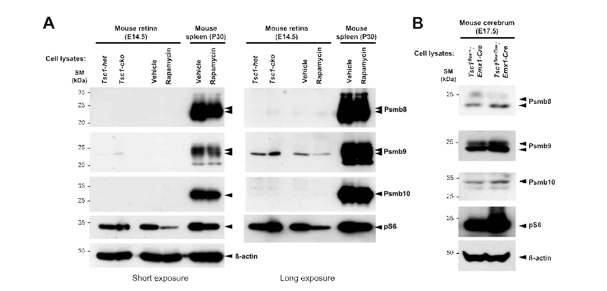 Spleen과 brain에서 mTORC1 활성에 민감한 immunoproteasome subunit 발현 변화. (A) 임신 14.5일 생쥐와 생후 30일 생쥐에 rapamycin을 복강 주사로 주입하고 12시간 이후 배아와 spleen을 분리하여 immunoproteasome subunit들인 Psmb8,9,10의 발현을 Western blot으로 조사함. (B) 수정 후 17.5 생쥐 배아 대뇌를 적출한 후 immunoproteasome subunit들인 Psmb8,9,10의 발현을 Western blot으로 조사함. 해당 샘플 내 mTORC1 활성도는 pS6의 양을 비교하여 검증함