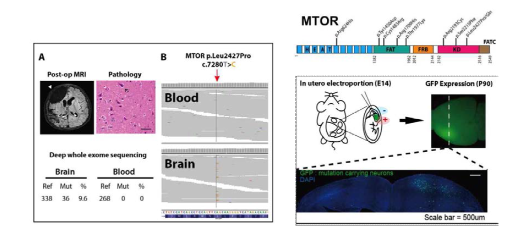 난치성 뇌전증 환자에서의 뇌 특이적 체성 유전변이 발굴 및 동물 모델 증명 데이터 (Lim et al Nature Medicine, 2015)