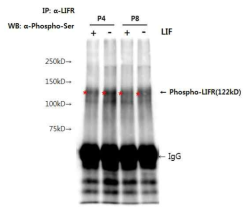 줄기세포의 니쉬에 따른 LIF 수용체의 인산화. 각 니쉬 조건에서 배양된 줄기 세포의 RIPA 추출액을 LIF 수용체 항체와 magnetic beads와 배양한 후, 세척하여 bead에 부착된 단백질을 SDS-PAGE 수행함. Phospho-Ser 항체로 Western blot을 수행함
