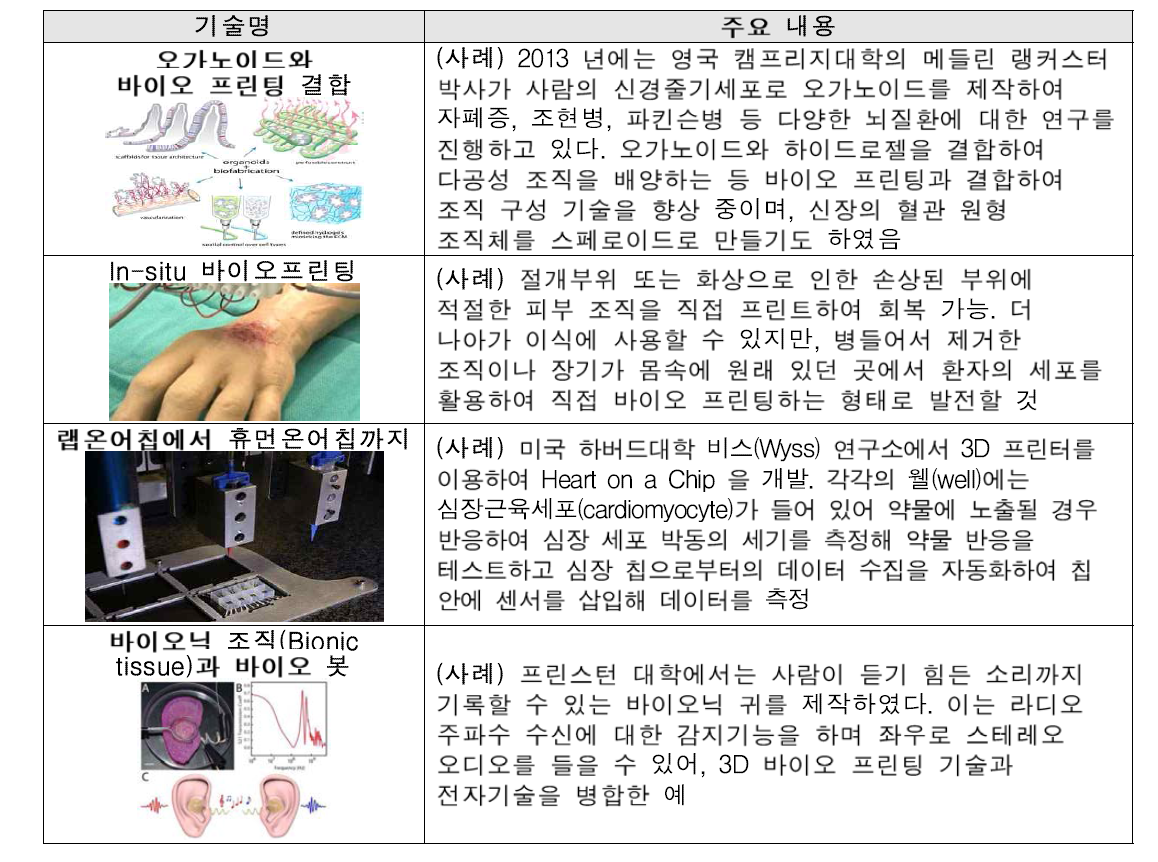 3D바이오프린팅 기술 사례