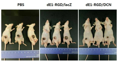 DCN 유전자를 발현하는 아데노바이러스에 의한 생체내 항종양 효과