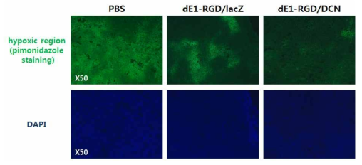 DCN 유전자를 발현하는 아데노바이러스에 의한 종양조직 내에서 저산소환경 변화