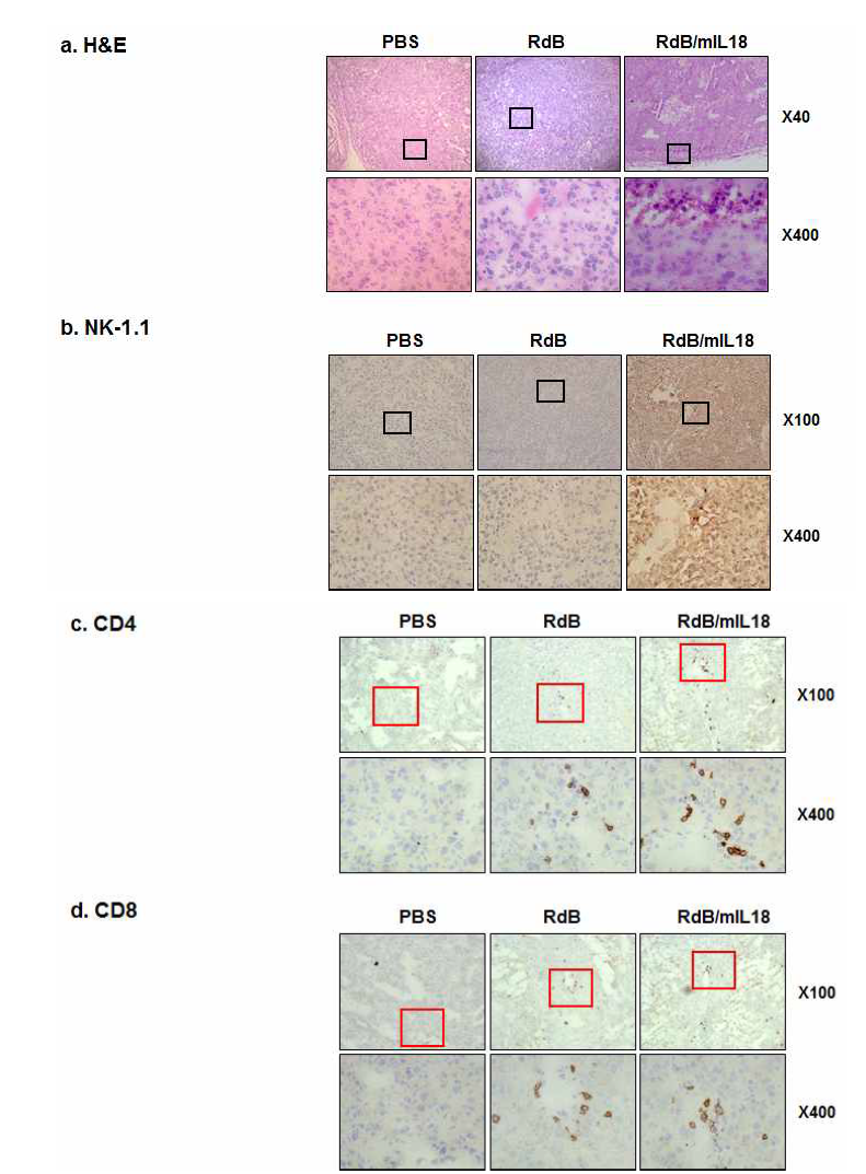 종양조직 내의 세포괴사 및 NK-1.1, CD4+, CD8+ T림프구의 침윤 검증