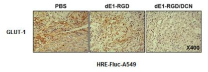 DCN 유전자를 발현하는 아데노바이러스에 의한 종양조직 내 GLUT-1 발현 억제 확인