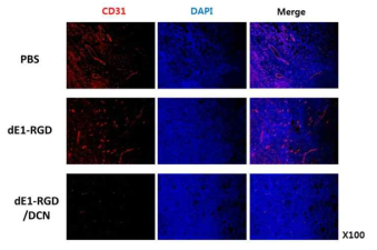 DCN 유전자를 발현하는 아데노바이러스에 의한 종양조직 내 신생혈관 형성 억제 확인