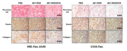 DCN 유전자를 발현하는 아데노바이러스에 의한 종양조직 내 세포외기질 성분의 발현 억제능 검증