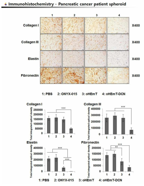 췌장암 환자 spheroid에서 DCN을 발현하는 종양 선택적 살상 아데노바이러스에 의한 췌장암 조직 내 세포외기질 주요성분의 변화 관찰