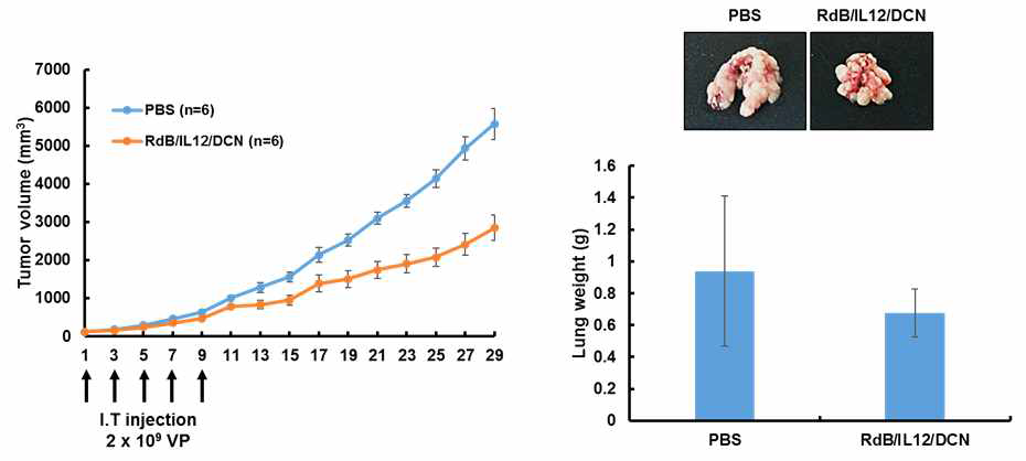 RdB/IL12/DCN 투여에 의한 항종양 효과 및 암 전이 억제능 확인