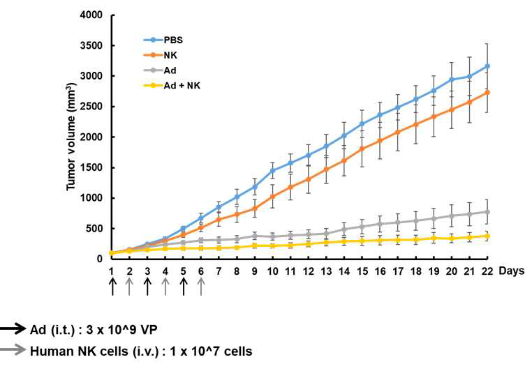 RdB/IL12/DCN 아데노바이러스와 human NK 병용 투여에 따른 향상된 항종양 효과 검증