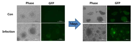 NK세포에 lenti virus를 이용하여, infection 을 실시함