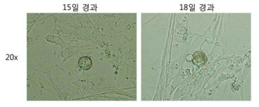 T세포에 sendai virus를 이용하여, 4 factor를 infection. 유도만능 줄기세포를 만드는 실험을 실시함(15-18일 경과)