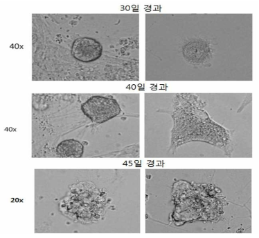 T세포에 sendai virus를 이용하여, 4 factor를 infection. 유도만능 줄기세포를 만드는 실험을 실시함(30-45일 경과)