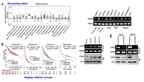 다양한 암에서의 GPR50 발현 패턴 분석