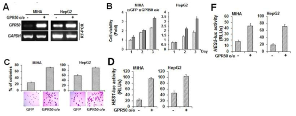간암세포에서의 GPR50의 과발현 및 신호전달 분석