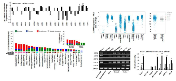 암세포에서의 KRT19의 발현 패턴 분석 결과
