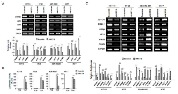 대장암과 유방암에서 KRT19의 Wnt / β-catenin / NOTCH 신호 전달 경로
