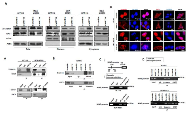 RAC1의 KRT19 /β-catenin complex 조절 및 결합