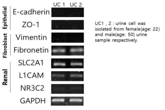 소변유래 세포에 대한 마커 확인