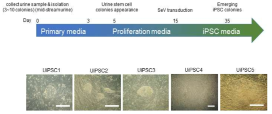 소변유래 세포로부터 유도만능 줄기세포 제작