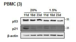 세포주기 억제 유전자의 단백질 발현 확인 PBMC (3)의 11일, 18일, 23일 째 배양한 세포의 단백질을 분리하여 세포주기 억제 유전자인 p21, p53에 대한 항체를 이용하여 웨스턴블랏을 수행함