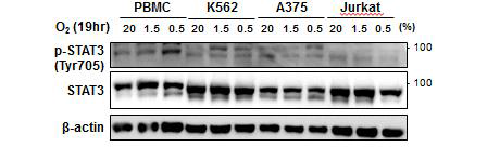 STAT3 단백질 발현 확인 그림 16과 같은 샘플에서 인산화된 STAT3와 STAT3의 발현을 확인함