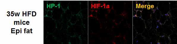 저산소 표지인자 확인 35주간 고지방식이를 한 쥐의 epidydimal 지방조직에서 pimonidazole (hypoxic probe-1, HP-1)과 HIF-1a 항체로 면역형광법을 수행함